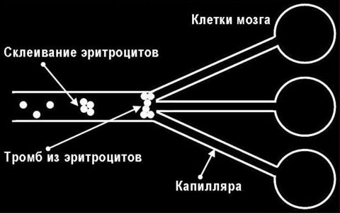 Пить или не пить...